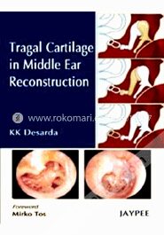 Tragal Cartilage in Middle Ear Reconstruction