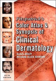 Fitzpatrick's Color Atlas and Synopsis of Clinical Dermatology
