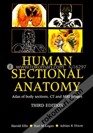 Human Sectional Anatomy Atlas of Body Sections, CT and MRI Images