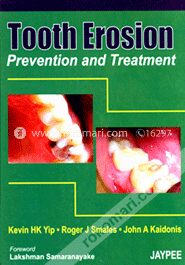 Tooth Erosion Prevention and Treatment