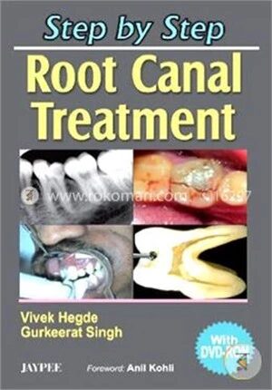 Step by Step Root Canal Treatment (with DVD Rom)