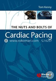 The Nuts and Bolts of Cardiac Pacing