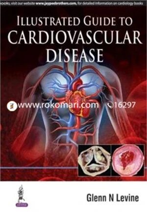 Illustrated Guide to Cardiovascular Disease