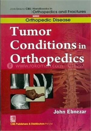 Tumor Conditions in Orthopedics