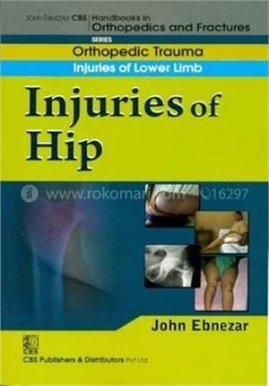 Injuries of Hip