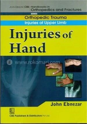 Injuries of Hand