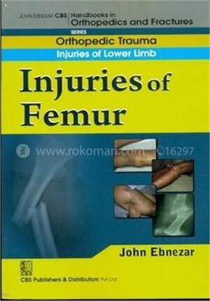 Injuries of Femur