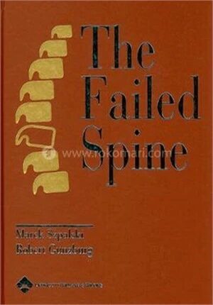 The Failed Spine