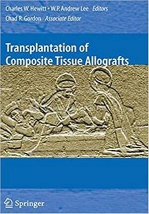 Transplantation of Composite Tissue Allografts