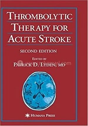Thrombolytic Therapy for Acute Stroke