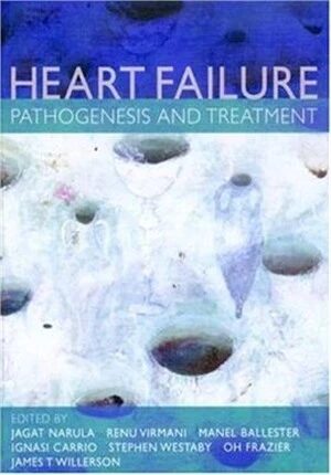 Management of Heart Failure